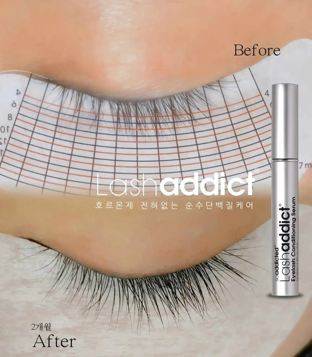 래쉬 게이지를 대고 측정한 래쉬애딕트 2개월 사용 전후 비교